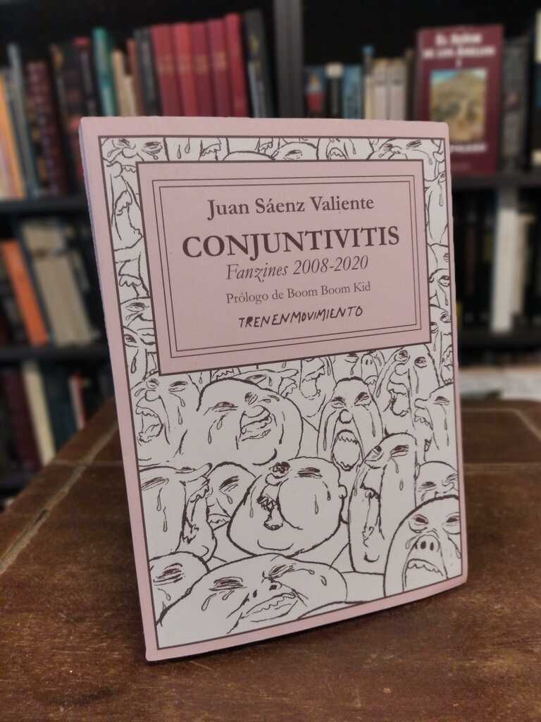 Conjuntivitis - Juan Sáenz Valiente